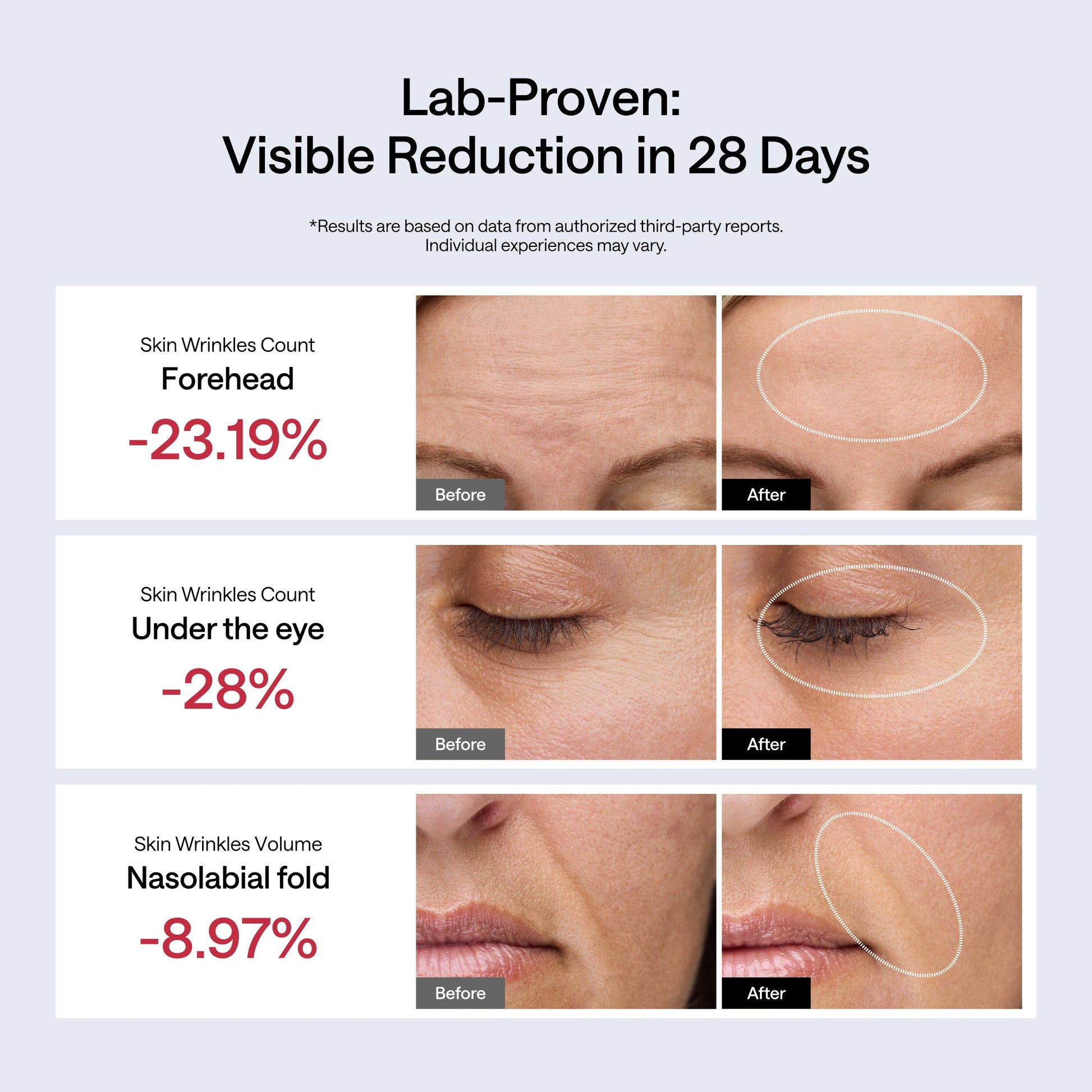 JMOON NouvelleSkin Facial Toning Device - JMOON