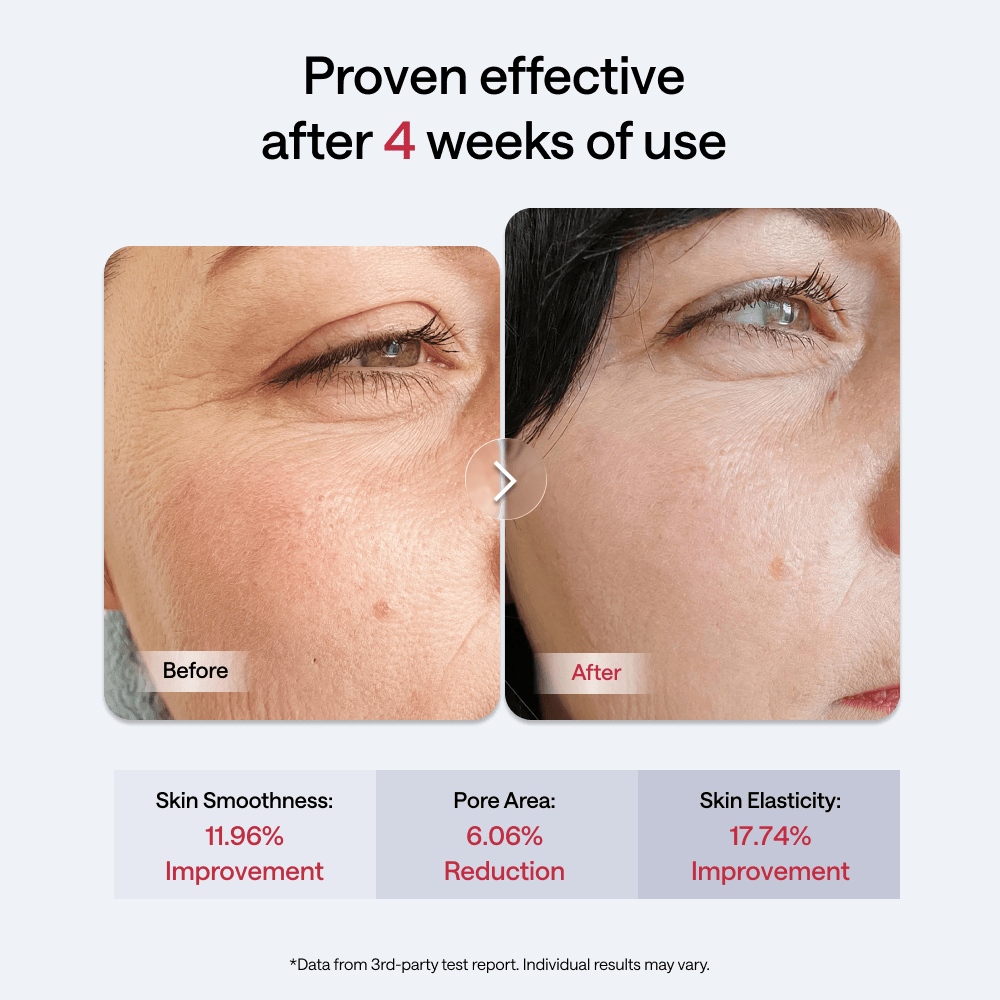 JMOON Transdermal EM50 - JMOON Official