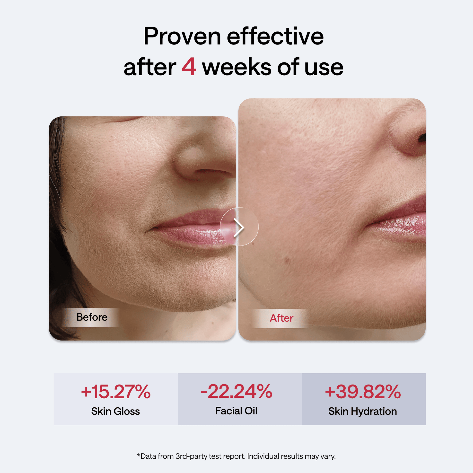 JMOON Transdermal Facial Toning Device EM50 - JMOON