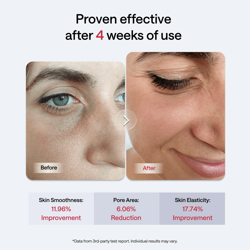 JMOON Transdermal Facial Toning Device EM50 - JMOON Official