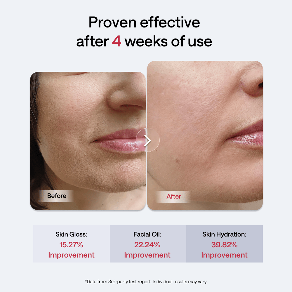 JMOON Transdermal Facial Toning Device EM50 - JMOON Official