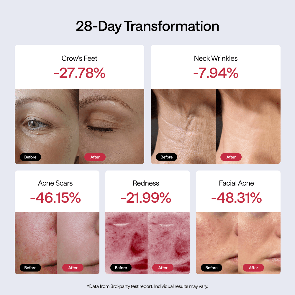 New Product Pre - Sale: JMOON Flexglow Light Therapy Device - JMOON Official